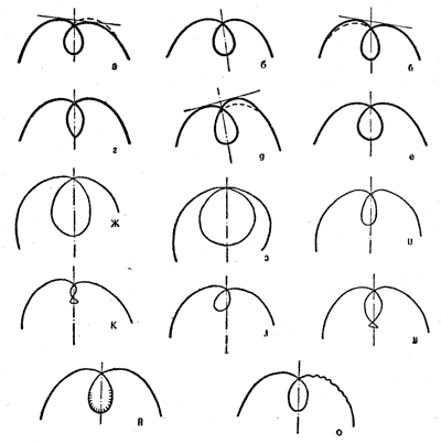 Рис. 29. Петля